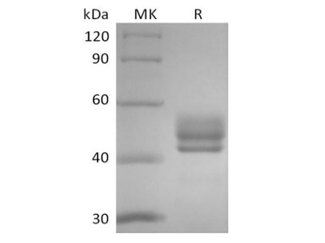 CD3E + CD3D Protein - Recombinant Human CD3D&CD3E Heterodimer (C-Fc-Flag&C-Fc-6His)