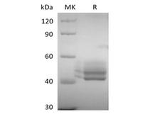 CD3E Protein - Recombinant Human CD3E&CD3G Heterodimer (C-Fc-6His&C-Fc-Flag)