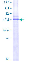 CD3E Protein - 12.5% SDS-PAGE of human CD3E stained with Coomassie Blue