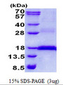 CD3E Protein