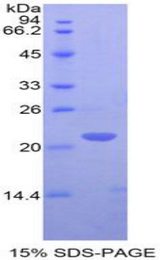 CD3E Protein - Recombinant T-Cell Surface Glycoprotein CD3 Epsilon By SDS-PAGE