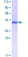 CD3EAP Protein - 12.5% SDS-PAGE Stained with Coomassie Blue.