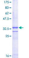 CD3G Protein - 12.5% SDS-PAGE Stained with Coomassie Blue.