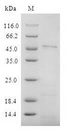 CD4 Protein - (Tris-Glycine gel) Discontinuous SDS-PAGE (reduced) with 5% enrichment gel and 15% separation gel.