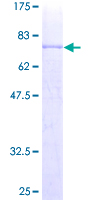 CD4 Protein - 12.5% SDS-PAGE of human CD4 stained with Coomassie Blue