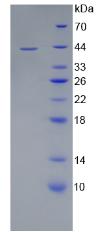 CD4 Protein - Recombinant Cluster Of Differentiation 4 By SDS-PAGE
