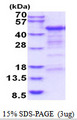 CD4 Protein
