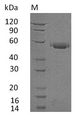 CD40 Protein - (Tris-Glycine gel) Discontinuous SDS-PAGE (reduced) with 5% enrichment gel and 15% separation gel.