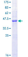 CD40 Protein - 12.5% SDS-PAGE of human CD40 stained with Coomassie Blue