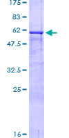 CD40 Protein - 12.5% SDS-PAGE of human CD40 stained with Coomassie Blue