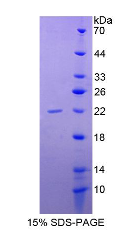 CD40 Protein - Recombinant Tumor Necrosis Factor Receptor Superfamily, Member 5 By SDS-PAGE