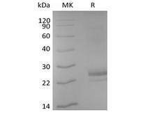 CD40L Protein - Recombinant Human CD40L/TNFSF5/CD40 Ligand (N-6His-Avi) Biotinylated