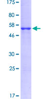 CD40L Protein - 12.5% SDS-PAGE of human CD40LG stained with Coomassie Blue