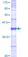 CD40L Protein - 12.5% SDS-PAGE Stained with Coomassie Blue.