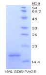 CD40L Protein - Recombinant Cluster Of Differentiation 40 Ligand By SDS-PAGE