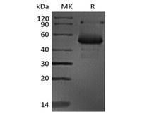 CD40L Protein - Recombinant Human CD40 Ligand/CD40L//TNFSF5 (N-mFc)