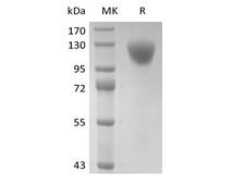 CD45 / LCA Protein - Recombinant Human CD45RA (C-6His)