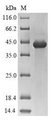 CD45 / LCA Protein - (Tris-Glycine gel) Discontinuous SDS-PAGE (reduced) with 5% enrichment gel and 15% separation gel.