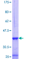 CD45 / LCA Protein - 12.5% SDS-PAGE Stained with Coomassie Blue.