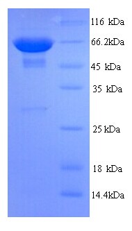 CD45 / LCA Protein