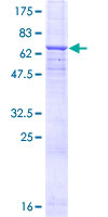 CD46 Protein - 12.5% SDS-PAGE of human CD46 stained with Coomassie Blue