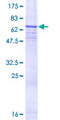 CD46 Protein - 12.5% SDS-PAGE of human CD46 stained with Coomassie Blue