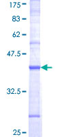 CD46 Protein - 12.5% SDS-PAGE Stained with Coomassie Blue.