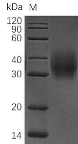 CD47 Protein - (Tris-Glycine gel) Discontinuous SDS-PAGE (reduced) with 5% enrichment gel and 15% separation gel.