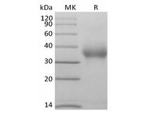 CD47 Protein - Human CD47/IAP/OA3 (C-Avi-6His) Biotinylated