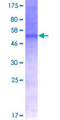 CD47 Protein - 12.5% SDS-PAGE of human CD47 stained with Coomassie Blue