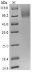 CD48 Protein - (Tris-Glycine gel) Discontinuous SDS-PAGE (reduced) with 5% enrichment gel and 15% separation gel.