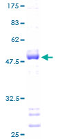 CD48 Protein - 12.5% SDS-PAGE of human CD48 stained with Coomassie Blue