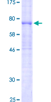 CD5 Protein - 12.5% SDS-PAGE of human CD5 stained with Coomassie Blue