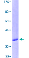CD5 Protein - 12.5% SDS-PAGE Stained with Coomassie Blue.