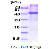 CD5 Protein