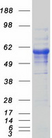 CD5 Protein - Purified recombinant protein CD5 was analyzed by SDS-PAGE gel and Coomassie Blue Staining