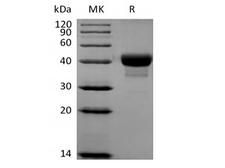 CD52 Protein - Recombinant Human CD52 (C-Fc-Avi) Biotinylated