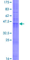 CD53 Protein - 12.5% SDS-PAGE of human CD53 stained with Coomassie Blue