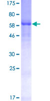 CD55 Protein - 12.5% SDS-PAGE of human DAF stained with Coomassie Blue