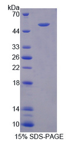 CD58 Protein - Recombinant Lymphocyte Function Associated Antigen 3 By SDS-PAGE