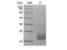 CD59 Protein - Recombinant Human CD59 (C-6His)