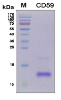 CD59 Protein - SDS-PAGE under reducing conditions and visualized by Coomassie blue staining