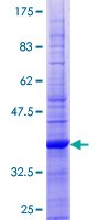 CD59 Protein - 12.5% SDS-PAGE of human CD59 stained with Coomassie Blue