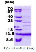 CD59 Protein