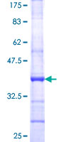 CD6 Protein - 12.5% SDS-PAGE Stained with Coomassie Blue.