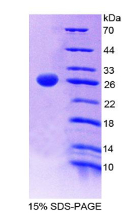 CD6 Protein - Recombinant Cluster Of Differentiation 6 By SDS-PAGE