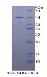 CD63 Protein - Recombinant Tetraspanin 30 By SDS-PAGE