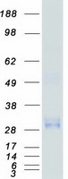CD63 Protein - Purified recombinant protein CD63 was analyzed by SDS-PAGE gel and Coomassie Blue Staining