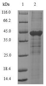 CD66a / CEACAM1 Protein - (Tris-Glycine gel) Discontinuous SDS-PAGE (reduced) with 5% enrichment gel and 15% separation gel.