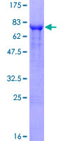 CD66a / CEACAM1 Protein - 12.5% SDS-PAGE of human CEACAM1 stained with Coomassie Blue